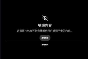 惊悚！慎看！范德彪小拇指骨头显露无疑！