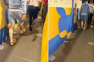 赖斯比赛后一瘸一拐地穿过混合采访区，左小腿绑着绷带